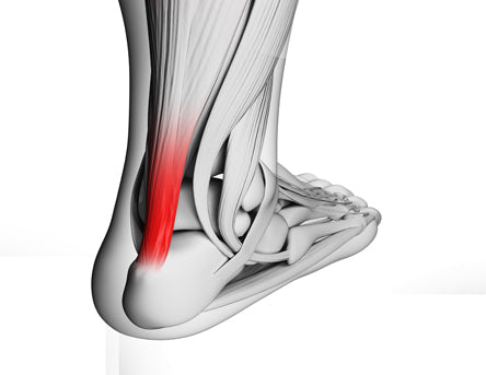 Why Relative Rest is so important when treating Achilles pain | Treat My  Achilles